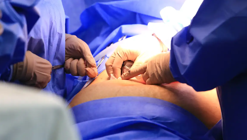 Programa nacional reduz filas cirúrgicas do SUS em cinco Estados 